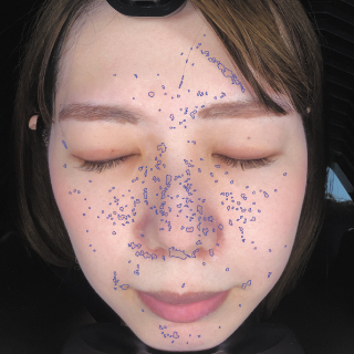 値下げしました！肌診断 Face DX9 値下げしました！肌診断 Face DX9 新