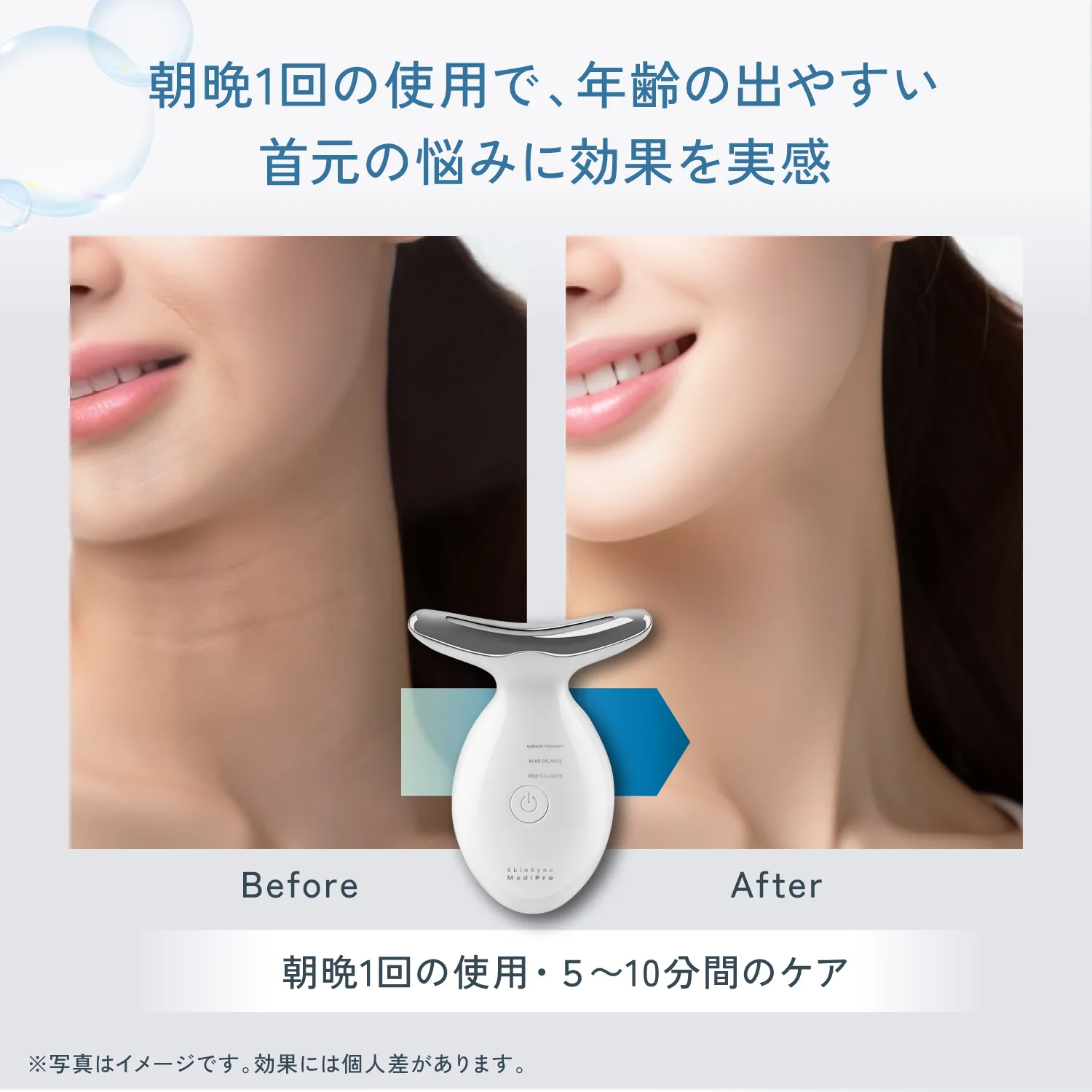 acu-rise 美顔器 しっぽ acu-rise 美顔器 しっぽ acu-rise 美顔器