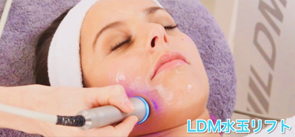 LDM水玉リフト | パンダ整骨院