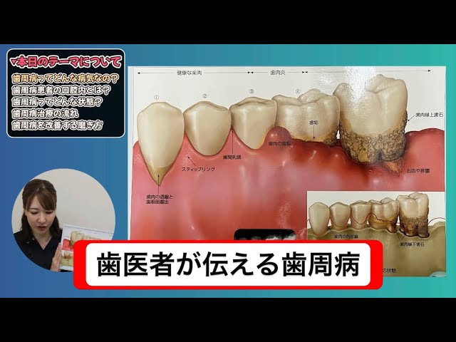 参考書 歯周病のメンテナンスについて 【公式通販】