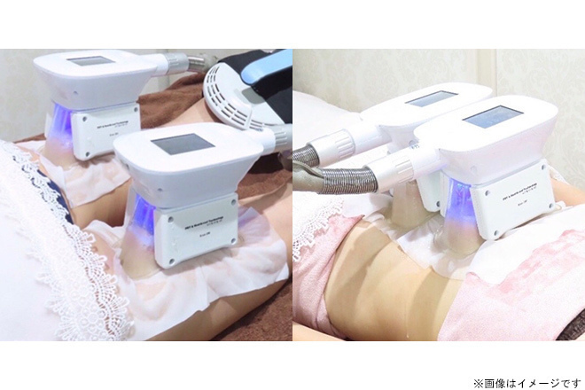 脂肪冷却 吸引カップ 脂肪冷却 吸引カップ｜Yahoo!フリマ（旧PayPay