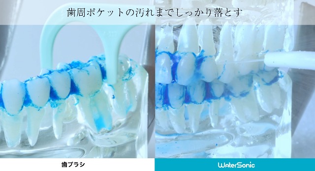Amazon.co.jp: Water Sonic ウォーターソニック 【歯科大学共同研究 歯