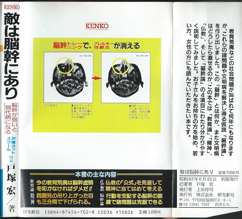 敵は脳幹にあり | 戸塚 宏 |本 | 通販 | Amazon