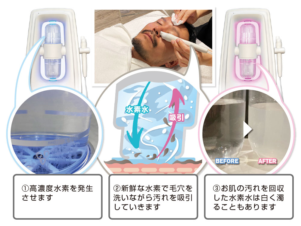 水素フェイシャル ハイドロインパクト 業務用エステ 毛穴洗浄 頭皮洗浄