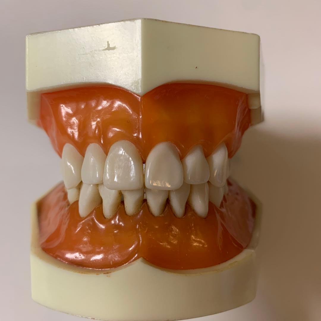 SRP実習用顎模型 [P15FE-X.770]｜株式会社ニッシン｜歯科模型・歯科 顎