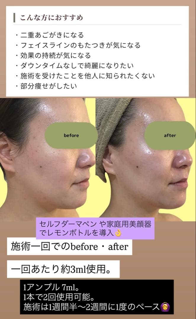 タムくん　レモンボトル×3本