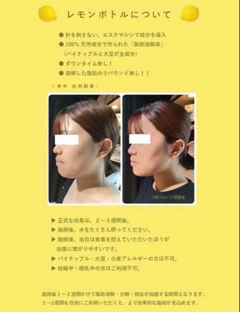 タムくん　レモンボトル×3本