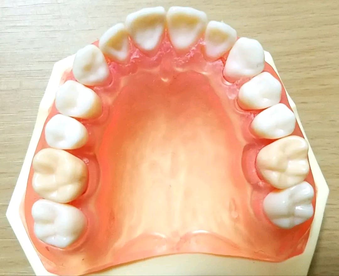 NISSIN DENTAL MODEL 顎模型 歯石セット セット売り