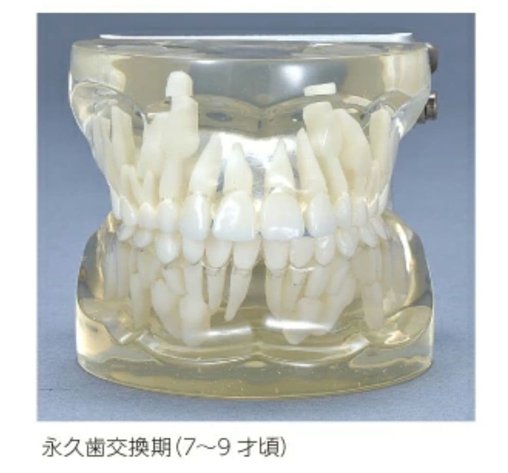 2個 歯列模型 実物大 開閉式 乳歯期 永久歯萌出前 永久歯 交換