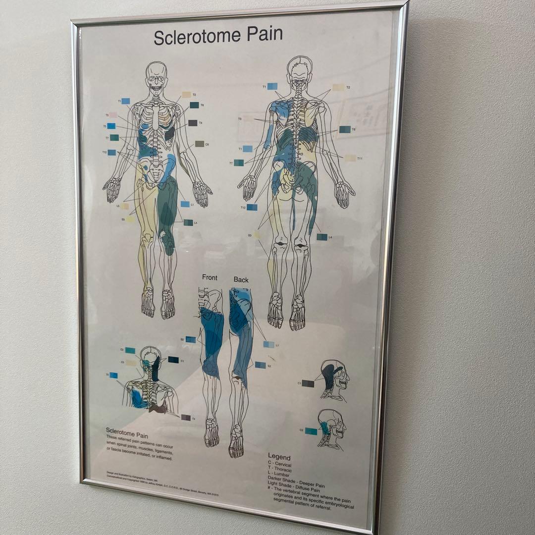 Sclerotome Pain 解剖図！カイロ！整体！鍼灸！エステ！トレーナー！ Sclerotome Pain 解剖図！カイロ！整体！鍼灸！エステ！トレーナー