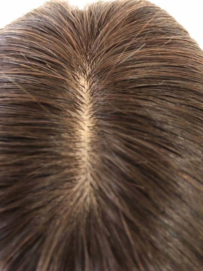 人毛100%ショートウィッグ　人毛ヘアピース　トップピース　部分ウィッグ　頭頂部