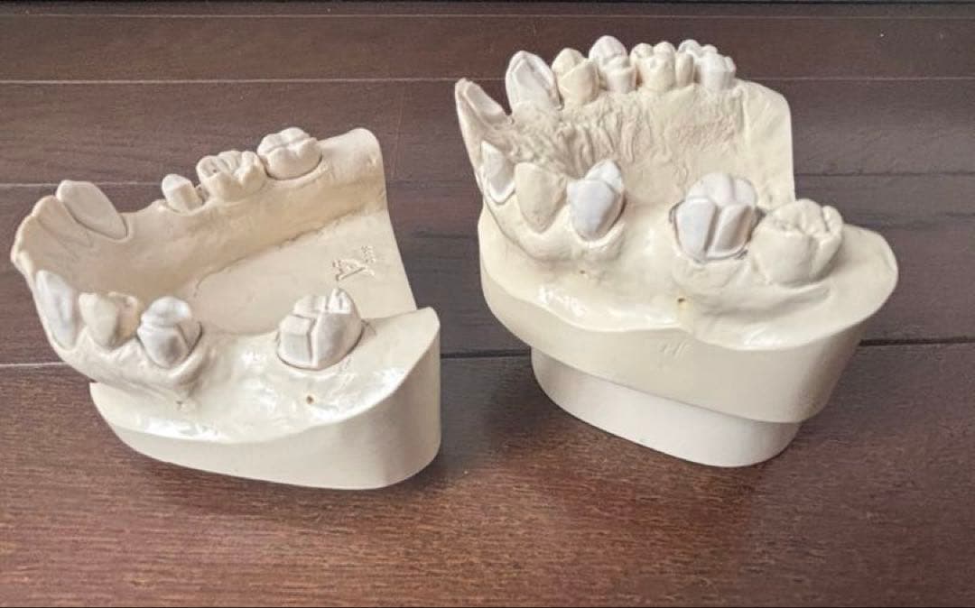 最終価格　歯科　支台歯形成　練習模型　セット