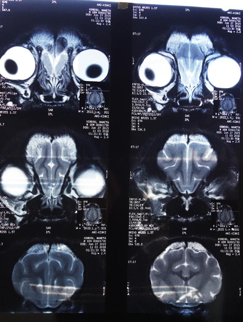 レントゲン 写真 3枚セット Z30 Nikon Z30は普段使いの最適解かも【実写